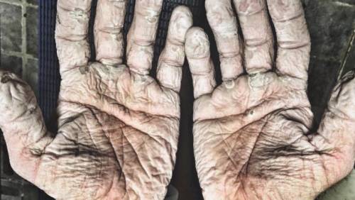 Il canottiere voga nell'Artico: la foto delle sue mani da il giro del web