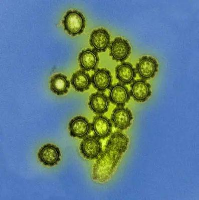 Il Nobel per la chimica a Dubochet, Frank e Henderson