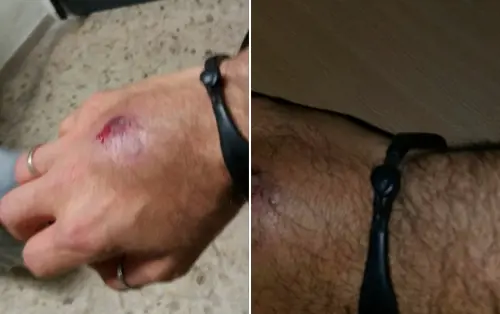 "Immigrato malato ha morso agente. E il giudice lo ha già liberato"