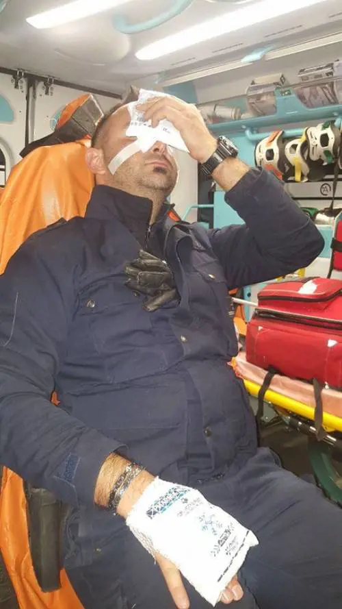 Milano, migrante con un ceppo di ferro massacra guardia sull'autobus