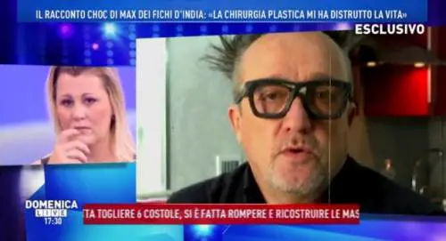 Max dei Fichi d'India: "Vita distrutta dalla chirurgia"