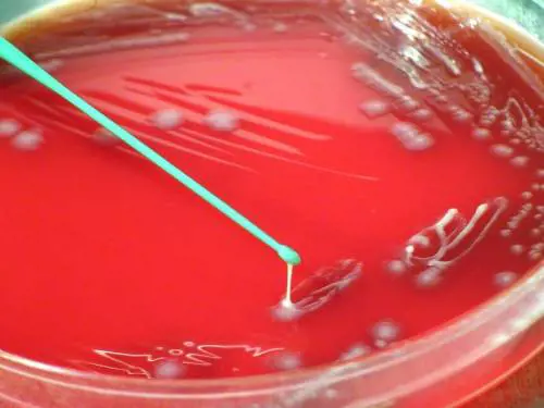 Primo focolaio in Europa della peste dei ruminanti