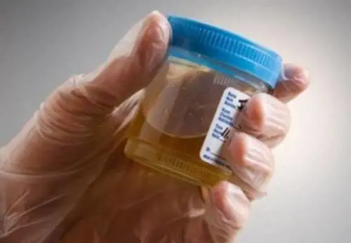 Rimini, medico usa la sua pipì ​per coprire la paziente drogata