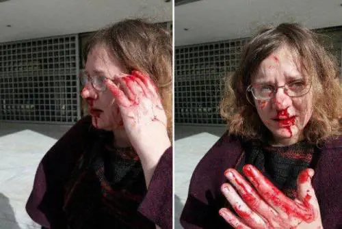 Atene, l'avvocato dei migranti aggredita da Alba Dorata