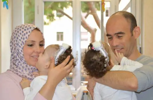 A Roma separate due gemelle siamesi algerine: ora stanno bene