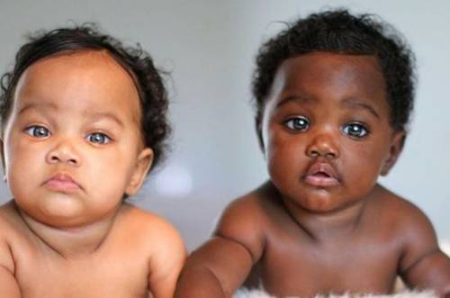 Le gemelline con il colore della pelle diverso diventano star di Instagram