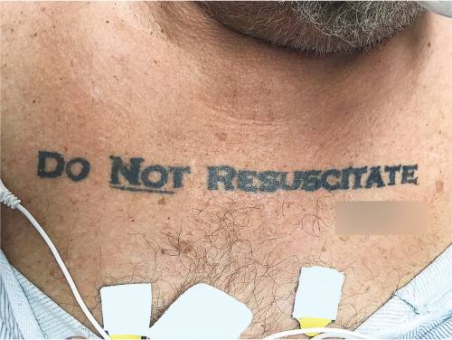 "Non rianimatemi", 70enne si tatua il testamento biologico sul petto