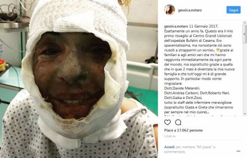 Gessica Notaro posta il primo selfie scattato dopo l'agguato dell'ex