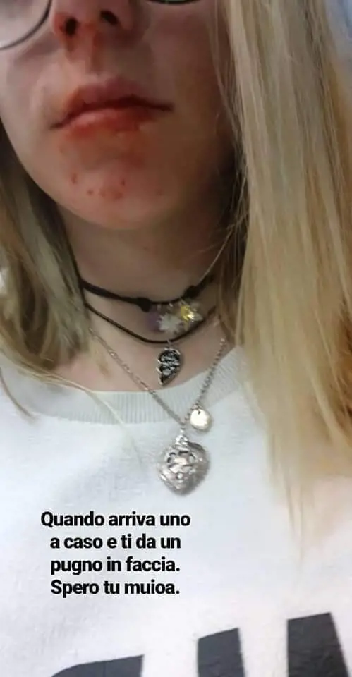 "Io, picchiata da un marocchino per 10 euro"