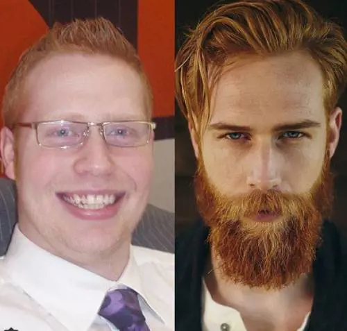 Da ragazzo goffo e sovrappeso a modello che posa per GQ