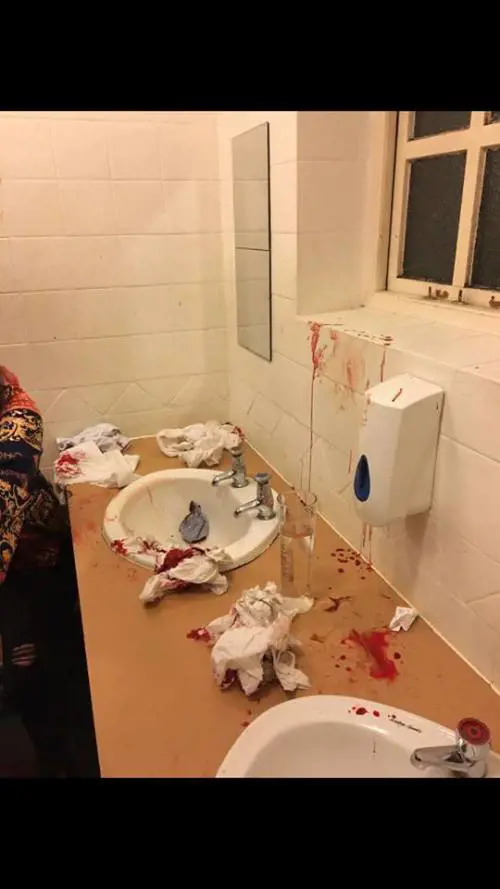 Inghilterra, massacrata di botte nel pub: "Guardava il mio fidanzato"