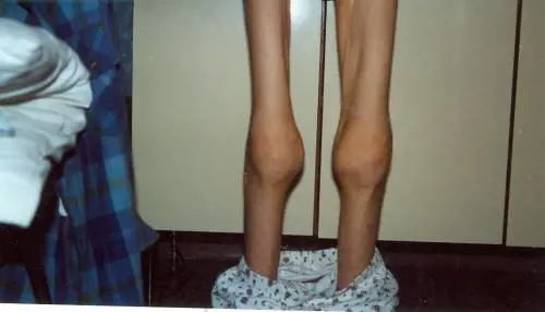 La setta del guru macrobiotico Gli adepti? Ridotti in schiavitù