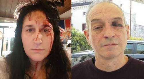 Vittorio Veneto, aggressione choc: Non danno vino al migrante. Cuoio capelluto strappato e marito pestato a sangue