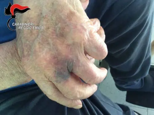 Reggio Emilia, pugni in faccia e insulti all'ospizio degli orrori