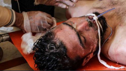 La verità dei medici di Douma: "Non è stato un attacco chimico"