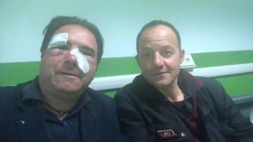 La brutale aggressione sul bus: controllori presi a calci e pugni