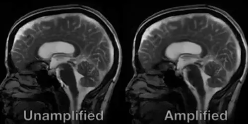 Il cervello "batte" come il cuore: il movimento ripreso per la prima volta