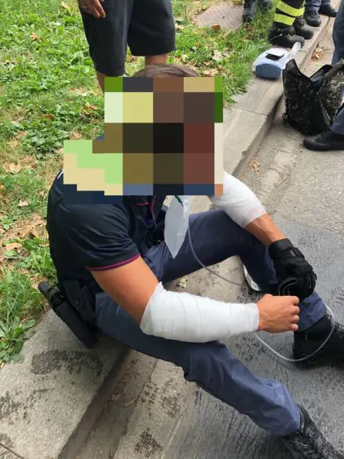 Milano, si dà fuoco in strada: le foto degli agenti feriti