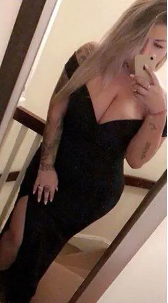 "L'acqua bollente ha sciolto il mio seno rifatto": il racconto choc della modella