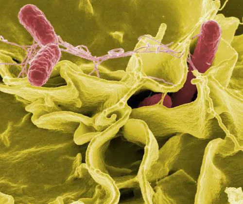 Bimbo di 10 anni con la salmonella: ecco cosa ha mangiato