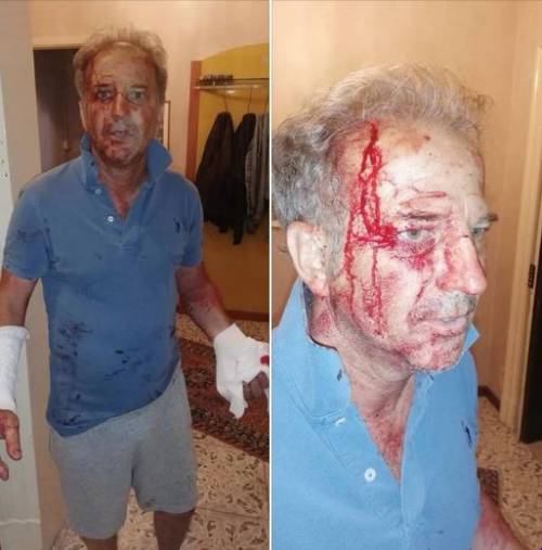 Migranti massacrano poliziotto. Pugnalato a sangue in casa: le foto choc