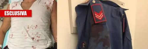 La furia dell'immigrato sui militari: sangue in caserma e tre feriti