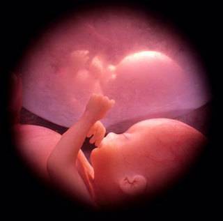 Torino, nuovo test del Dna fetale: basterà un prelievo