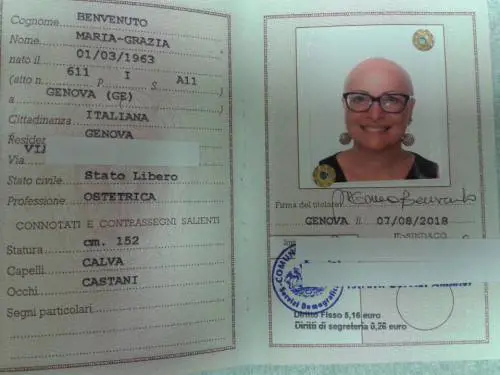 "Ho battuto la burocrazia: basta parrucche, sono ufficialmente calva"