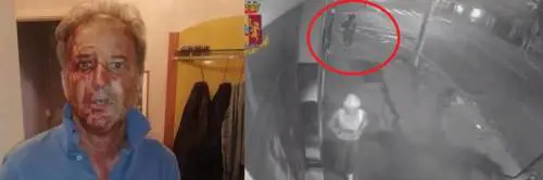 Migranti massacrano poliziotto. Il video incastra un clandestino