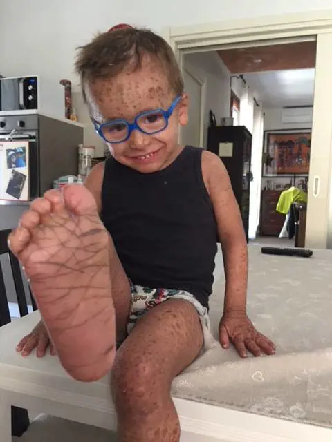 Tommy e la vita appesa a un enzima