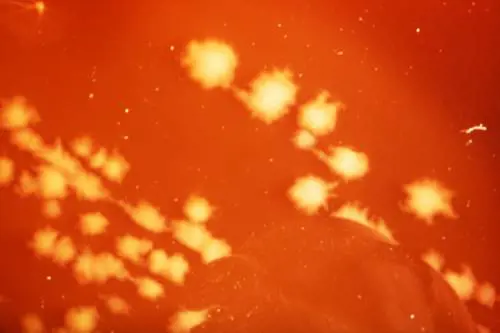 Si punge con una rosa: donna finisce in coma per un batterio killer mentre fa giardinaggio