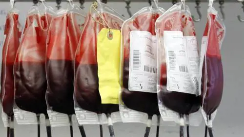 Gran Bretagna, sangue infetto giunto dagli Usa ha causato 3 mila morti