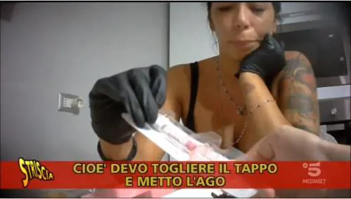 Napoli, chirurgia plastica nella cucina di casa
