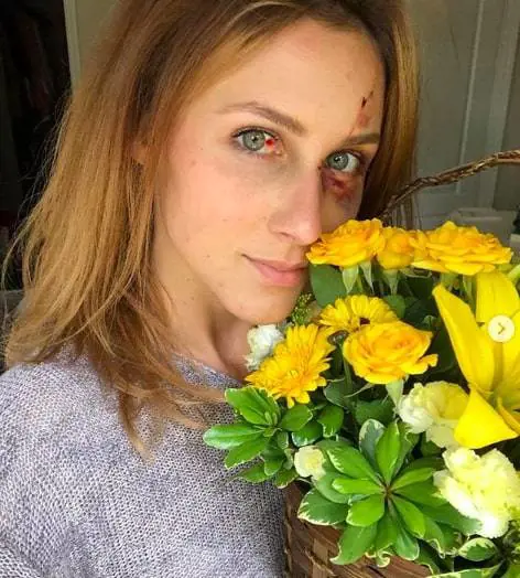 Pubblica una foto troppo scollata su Instagram, il fidanzato la picchia