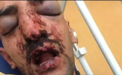 La foto di Nabil in ospedale, diffusa dai familiari