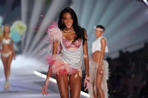 La sfilata di Winnie Harlow