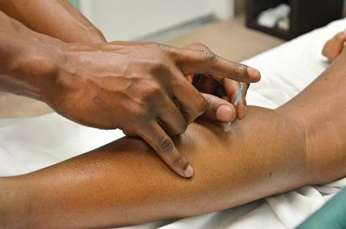 Agopuntura e Fitoterapia: i metodi della medicina naturale