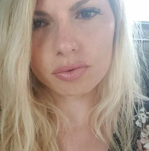 Si rifà il seno e muore per un coagulo di sangue