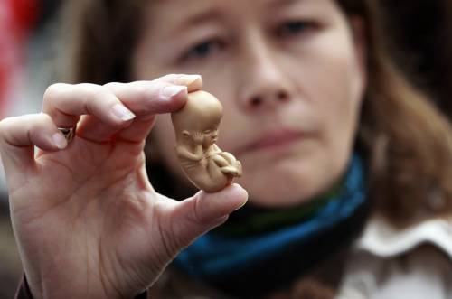 Aborto, ora spunta quello "postnatale" per le malattie genetiche