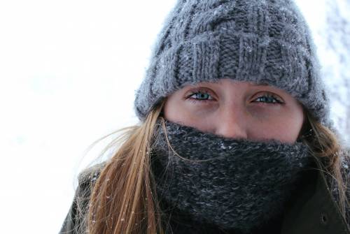 Allergica all'inverno: è orticaria da freddo
