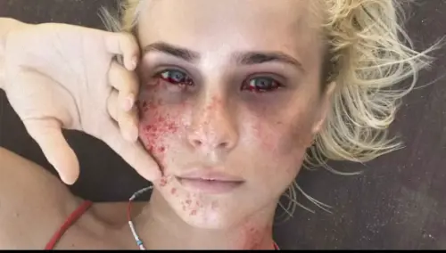 Modelle come malate di Ebola: la campagna choc delle ong olandesi