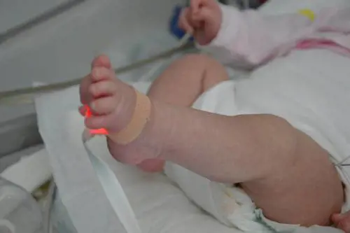 Droga nel sangue e nelle urine: bimba di 2 anni in coma
