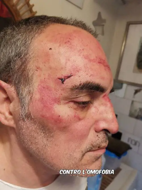 Aggredito dai condomini nella palazzina dove vive: ​"Sei gay, ti ammazziamo"