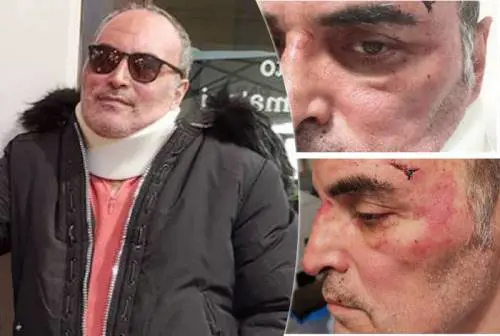 Omosessuale aggredito I residenti: "Macché omofobia Beveva e spaccava le auto"