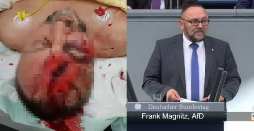 L'AfD contro il clima d'odio in Germania: "Qui la sinistra ci vuole morti"