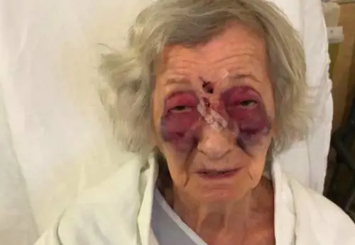 Canada, sopravvissuta all'Olocausto picchiata su un bus