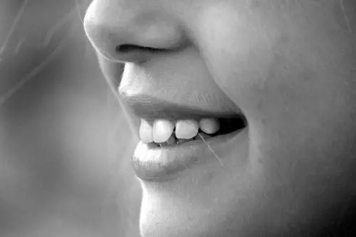 La dieta ideale per la salute dei nostri denti