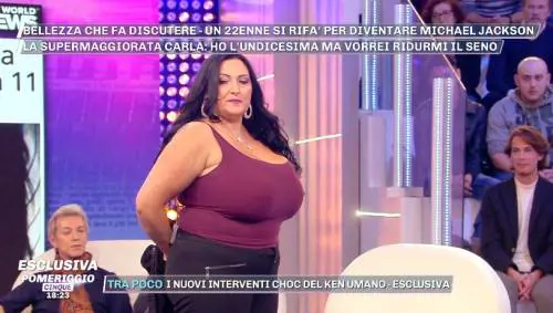 Carla Ruggiero: "Ecco cosa vuol dire soffrire di gigantomastia"