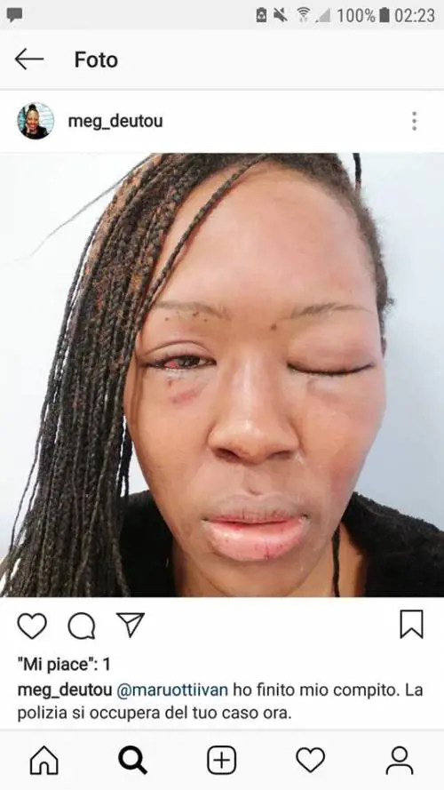 Pestata dall'ex fidanzato: lo incastra con questa foto sui social