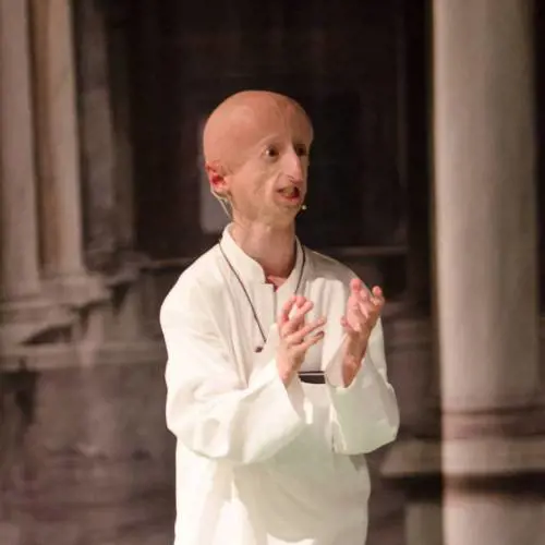 Sammy Basso, malato di progeria, operato con successo al cuore